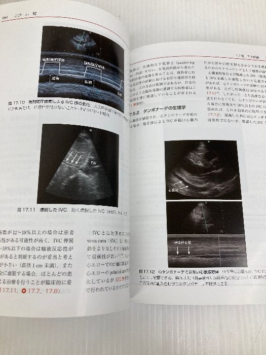 【中古】 ＰｏｉｎｔーｏｆーＣａｒｅ超音波 電子書籍（日本語・英語版）付 原書第２版/エルゼビア・ジャパン/ニラム・Ｊ．ソニ 71o7TW1rh5L._UF1000,1000_QL80_.jpg