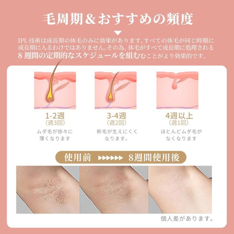 ✴️ 大好評 脱毛器 永久脱毛 IPL光脱毛器 VIO脱毛 フラッシュ脱毛器 冷却 全身脱毛 メンズ レディース 冷却機能 ワキ 腕 足 背中 ビキニライン