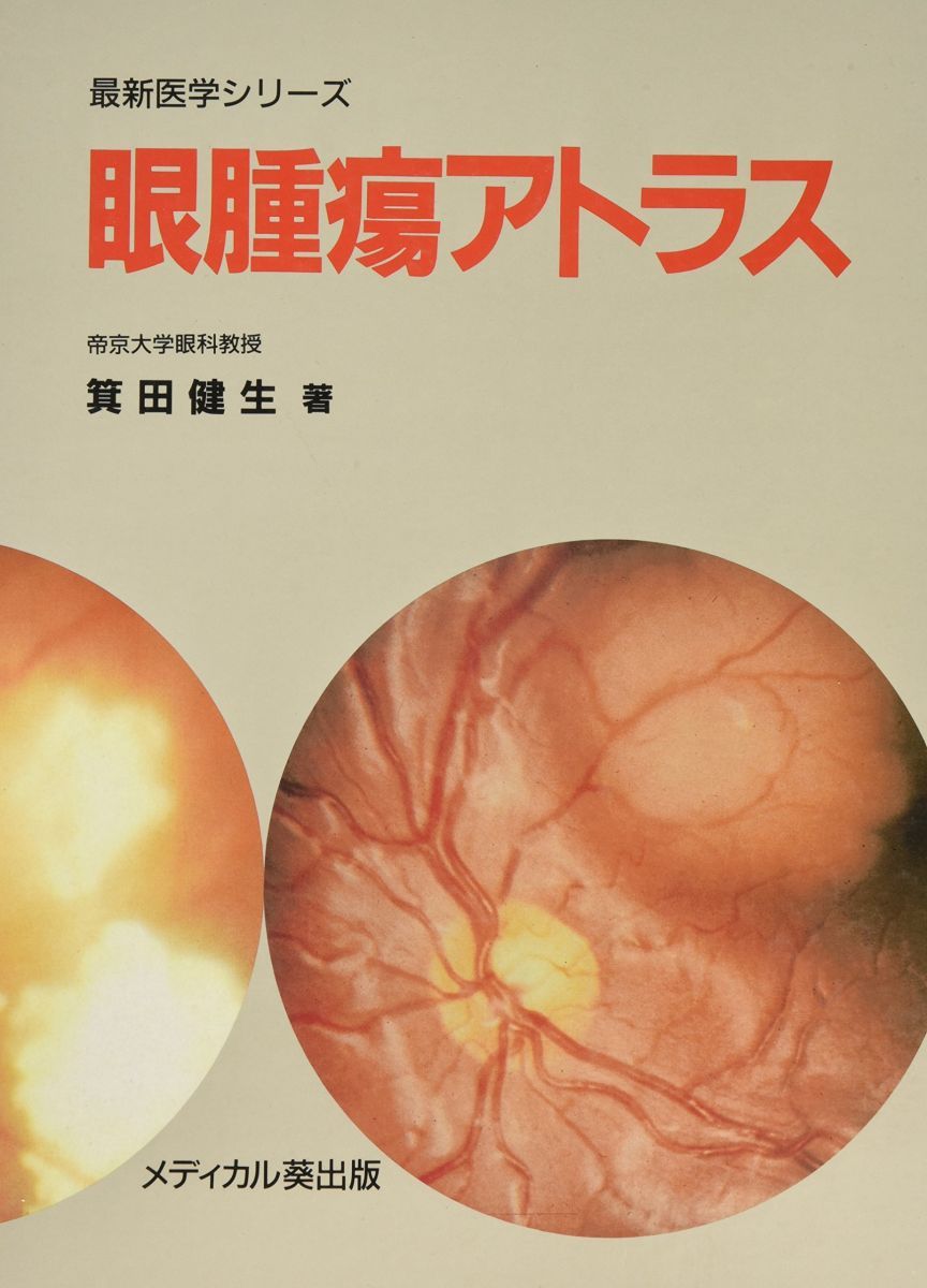 眼腫瘍アトラス (最新医学シリーズ) 箕田健生 眼腫瘍アトラス (最新医学シリーズ) 箕田健生 - メルカリ