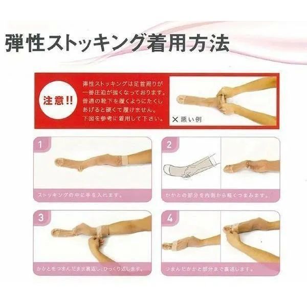 【新品】医療用弾性ストッキング　レックスフィット　（薄手ハイソックス）（爪先なし）弾性ストッキング 医療用 下肢静脈瘤 着圧ストッキング 医療用着圧ソックス 靴下 つま先なし 静脈瘤 予防 （中圧）（Mサイズ）（ ライトベージュ）1042