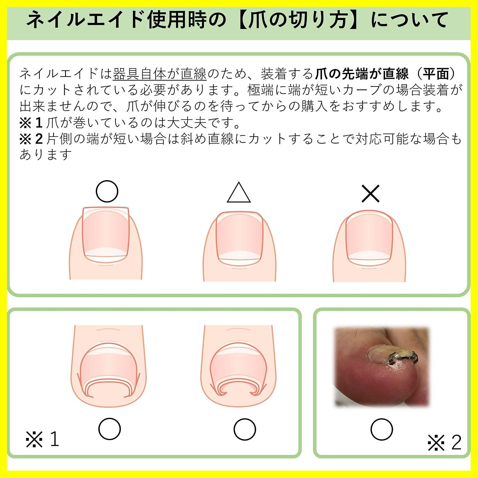 特価セール】14㎜ 巻き爪 矯正 ネイルエイド 自分で 巻きづめ ワイヤー ...