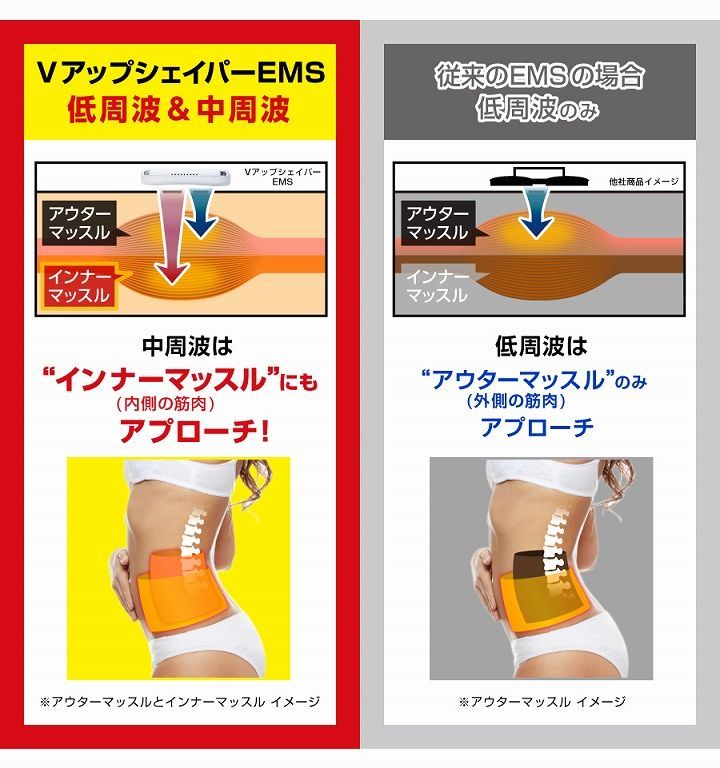 EMS
