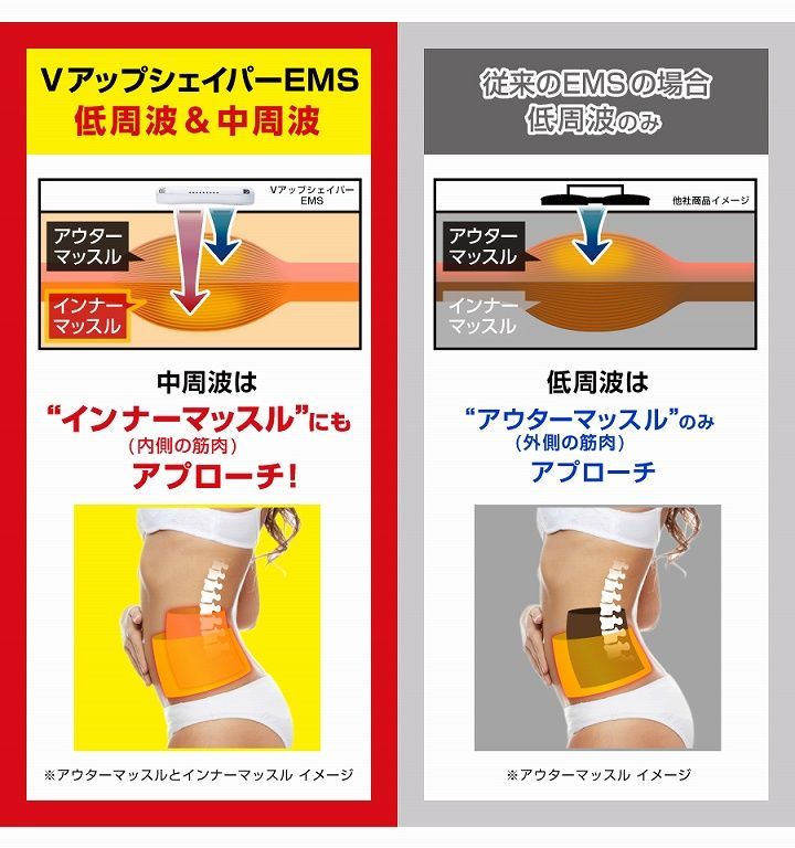 VアップシェイパーEMS 4L べージュ