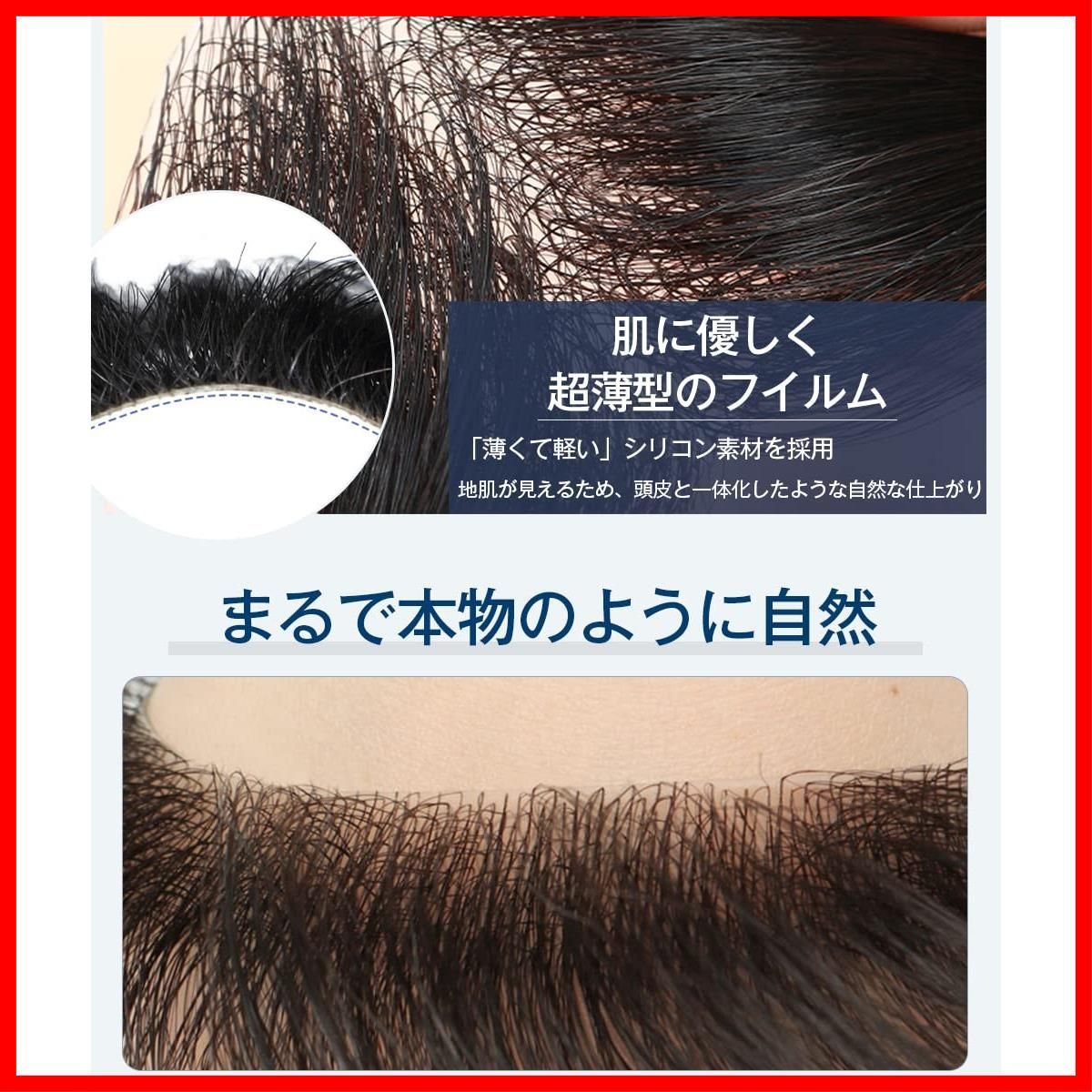 生え際 薄毛