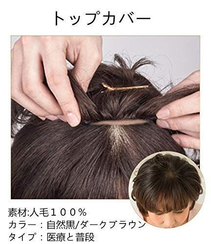 総手植え人毛