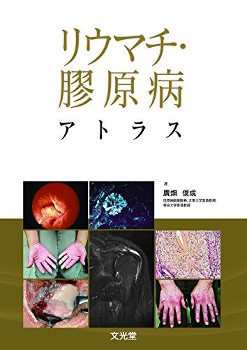 リウマチ・膠原病アトラス／廣畑 俊成