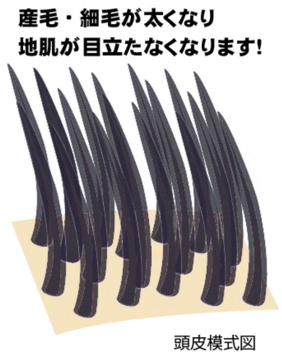 薄毛隠し 円形脱毛