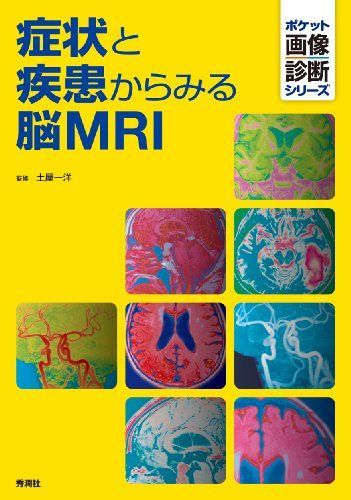 2022年版MRIとCTの違い分かる？療法士向け分かりやすい脳画像の見方 CT