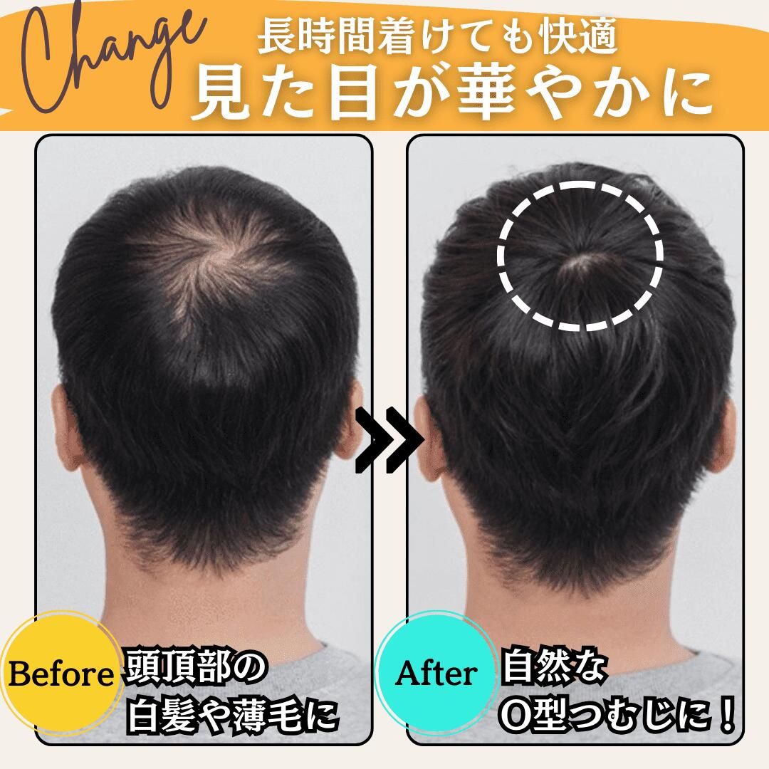 △頭頂部 ウィッグ 部分かつら ヘアピース 自然 温う ブラック つけ毛 メンズ171