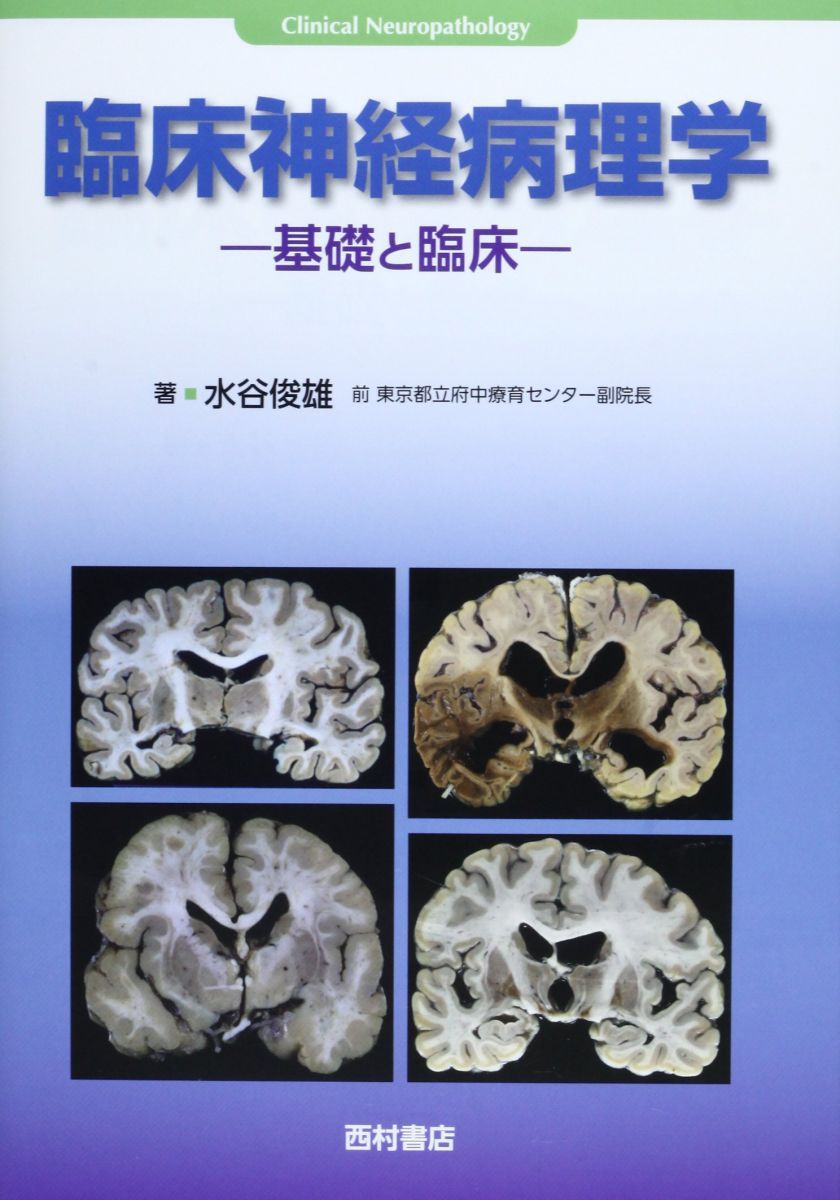 臨床神経病理学: 基礎と臨床 水谷 俊雄