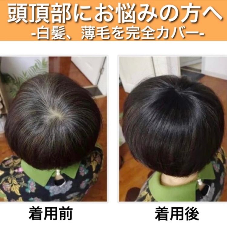 高級人毛100％ ヘアピース ブラック 医療 部分ウィッグ トップカバ