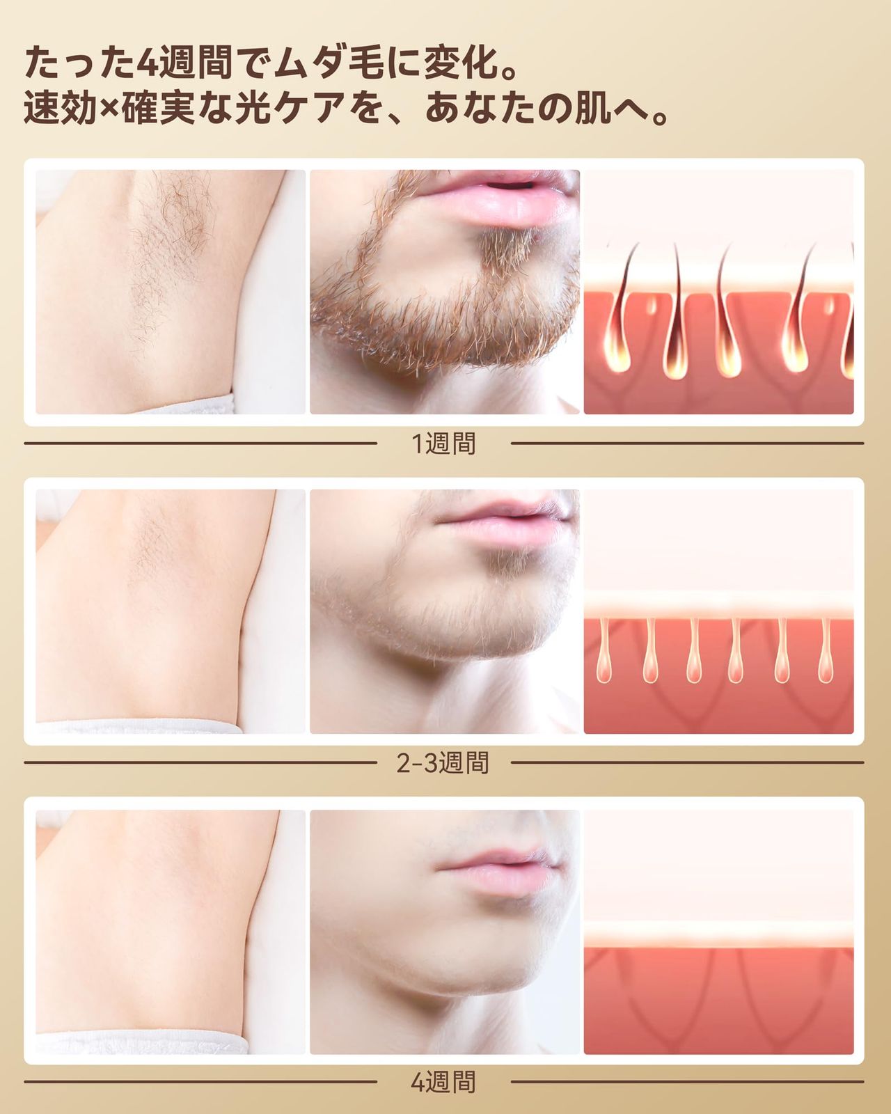 YUNDOO 脱毛器