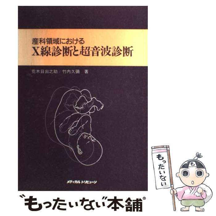 産科領域におけるＸ線診断と超音波診断/メディカルトリビュ-ン/荒木日出之助（単行本） 産科領域におけるX線診断と超音波診断 | 荒木 日出之助, 竹内 久弥 |本