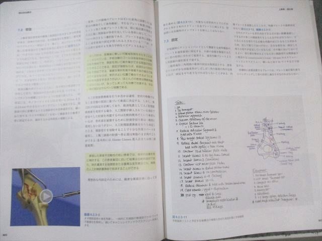 医学書院 AO法 骨折治療 第3版 2020 055R3D（AO法骨折治療[英語