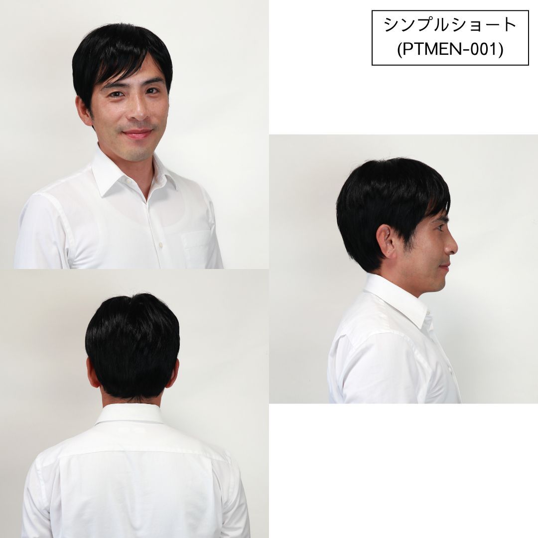 抜け毛 脱毛症