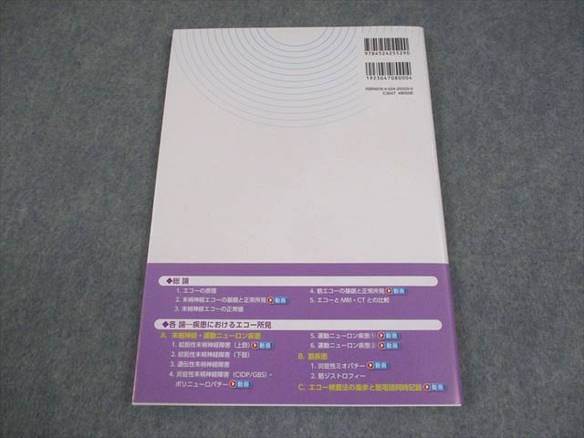 南江堂 神経筋疾患の超音波検査実践マニュアル 2018 012S3D 415fVVVe+wL._BO30,255,255,