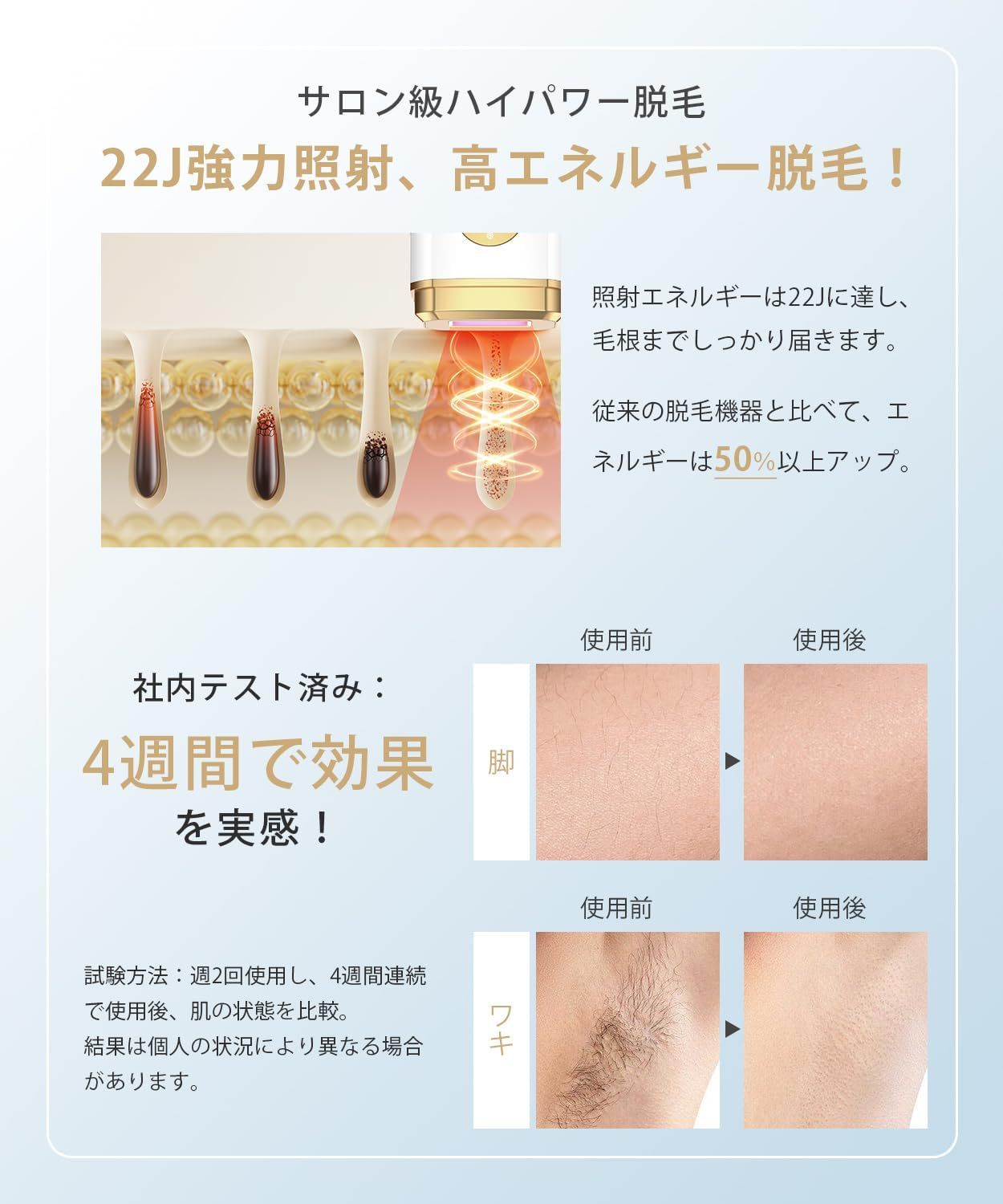 脱毛器 VIO対応【2025年夏新モデル・IPL・サファイア冷却技術でほぼ