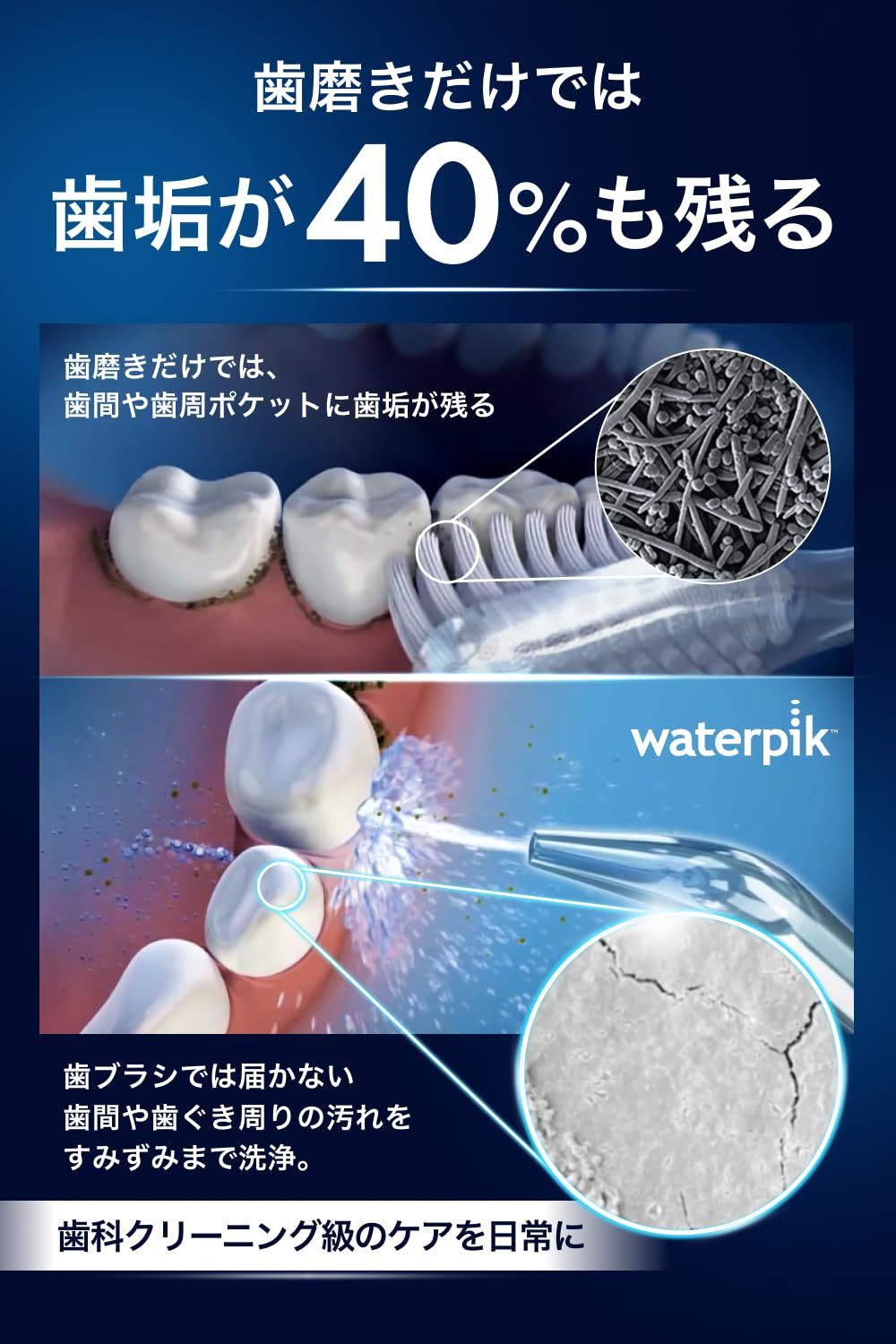 waterpik ウォーターピック【正規品】世界シェアNo,1 世界の歯科医推奨