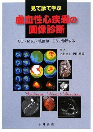 見て診て学ぶ虚血性心疾患の画像診断―CT・MRI・核医学・USで診断する [単行本] 文子，木村; 重敬，西村 急性期脳梗塞の画像診断 (画像診断 40巻14号) | 医書.jp