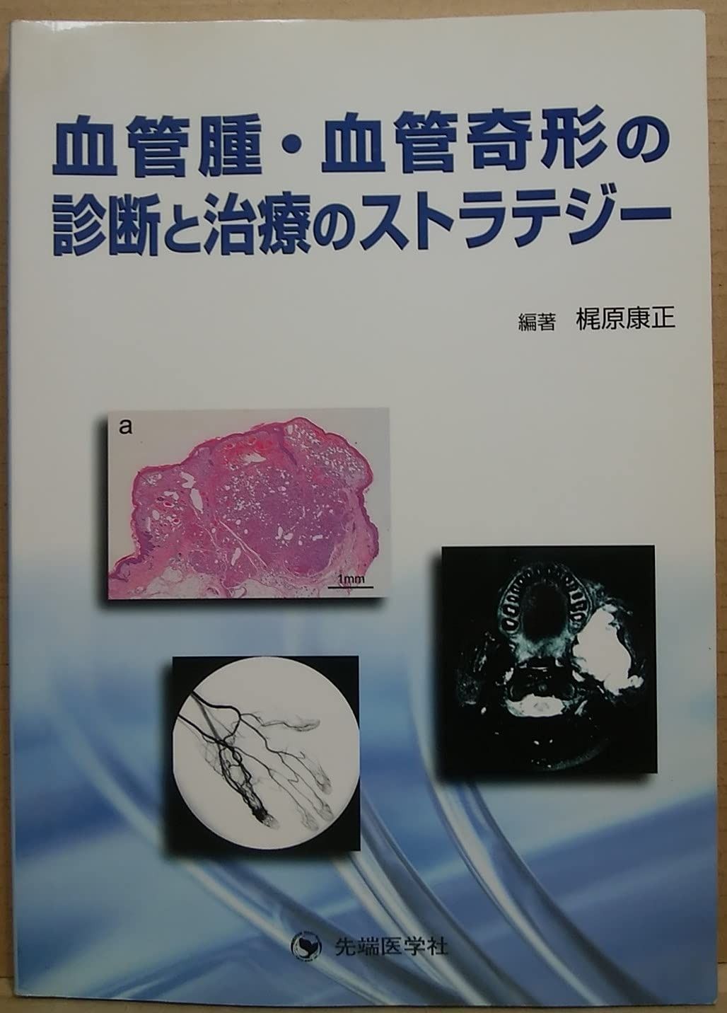 血管腫 血管奇形の診断と治療のストラテジ-