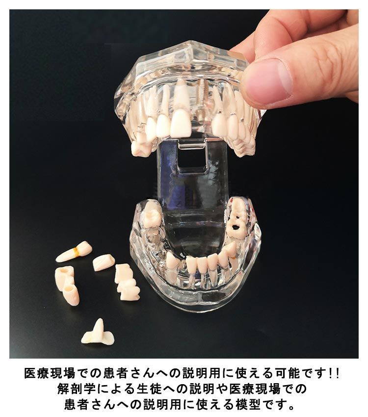 歯科モデル人体解剖学分離可能な歯の解剖学モデル医学教育モデル