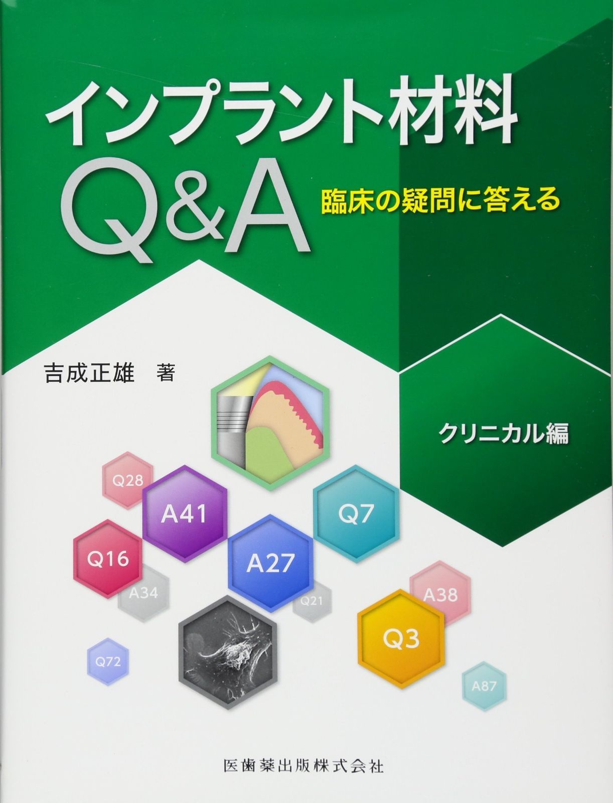 インプラント材料Q-A 臨床の疑問に答える クリニカル編