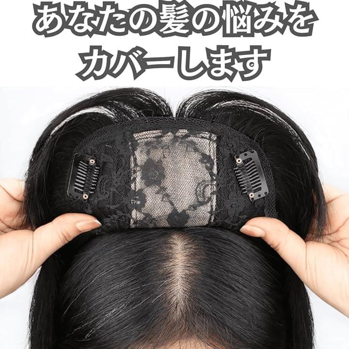 薄毛 脱毛