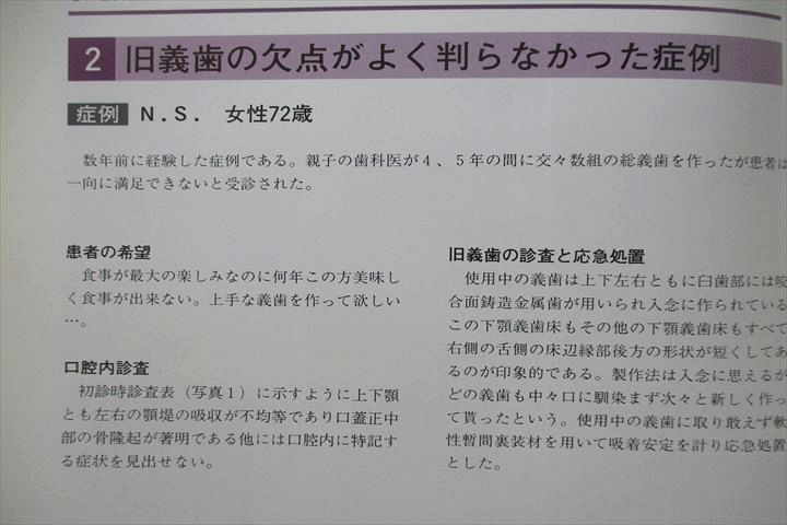 UR26-007 永末書店 良く噛める総義歯 1993 山本為之 12m3D - メルカリ