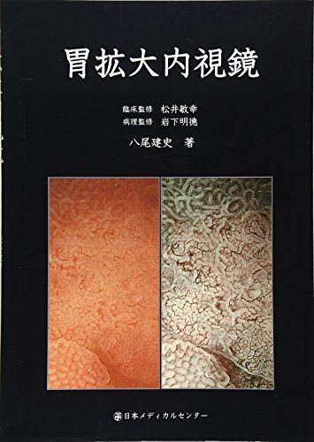 胃拡大内視鏡 医師出演】NBI・BLIによる胃がんの拡大内視鏡診断とは