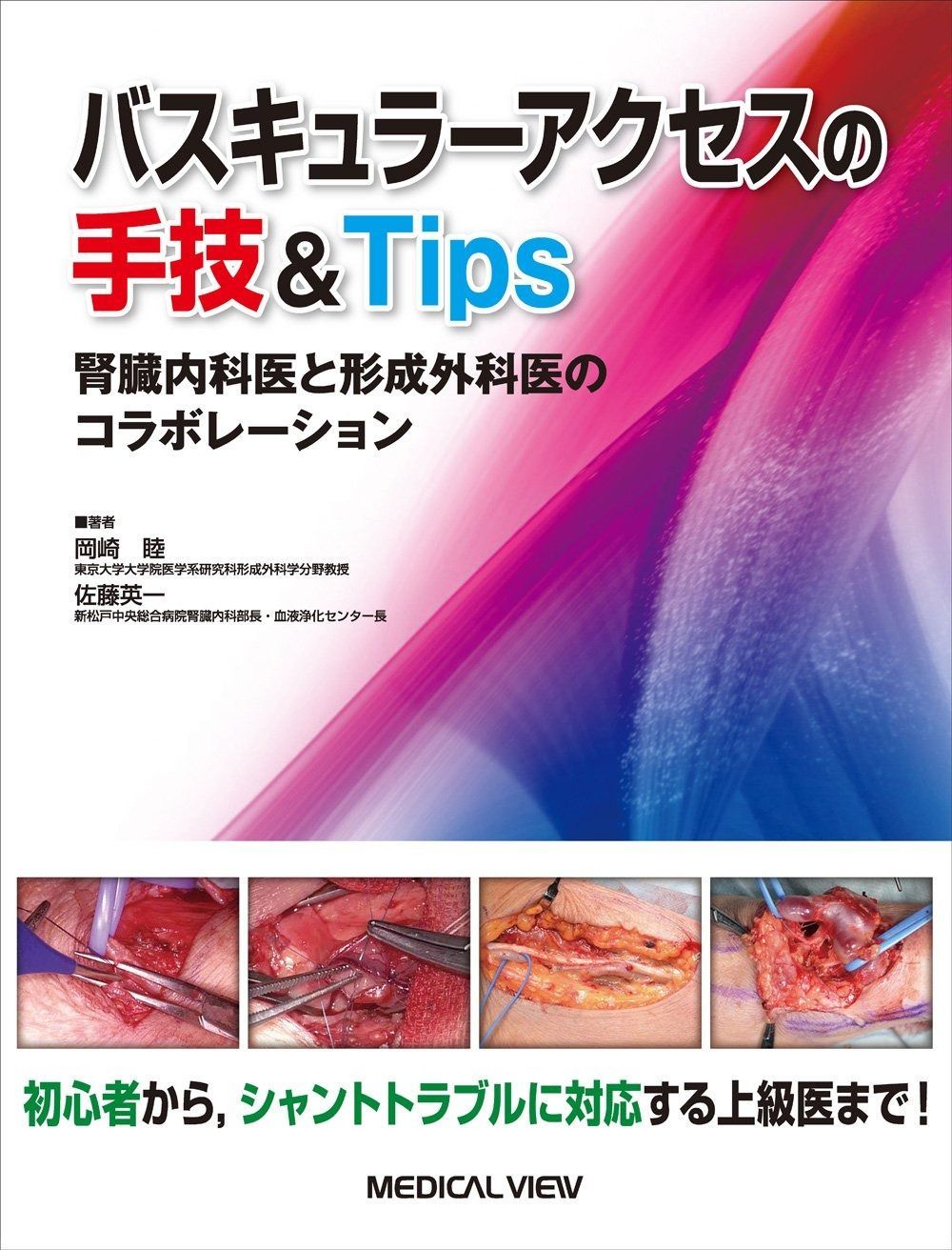 バスキュラーアクセスの手技-Tips?腎臓内科医と形成外科医のコラボレーション