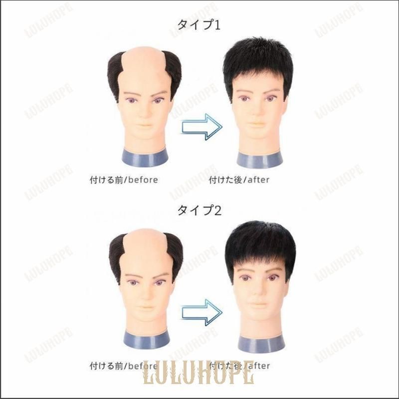 薄毛対策