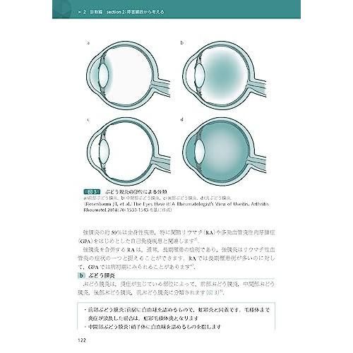 フィジカルアセスメントで追いつめる! リウマチ・膠原病診療