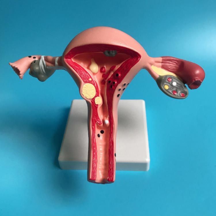 人体模型 女性器官 51qtL-2qO3L._UF350,350_QL80_.jpg