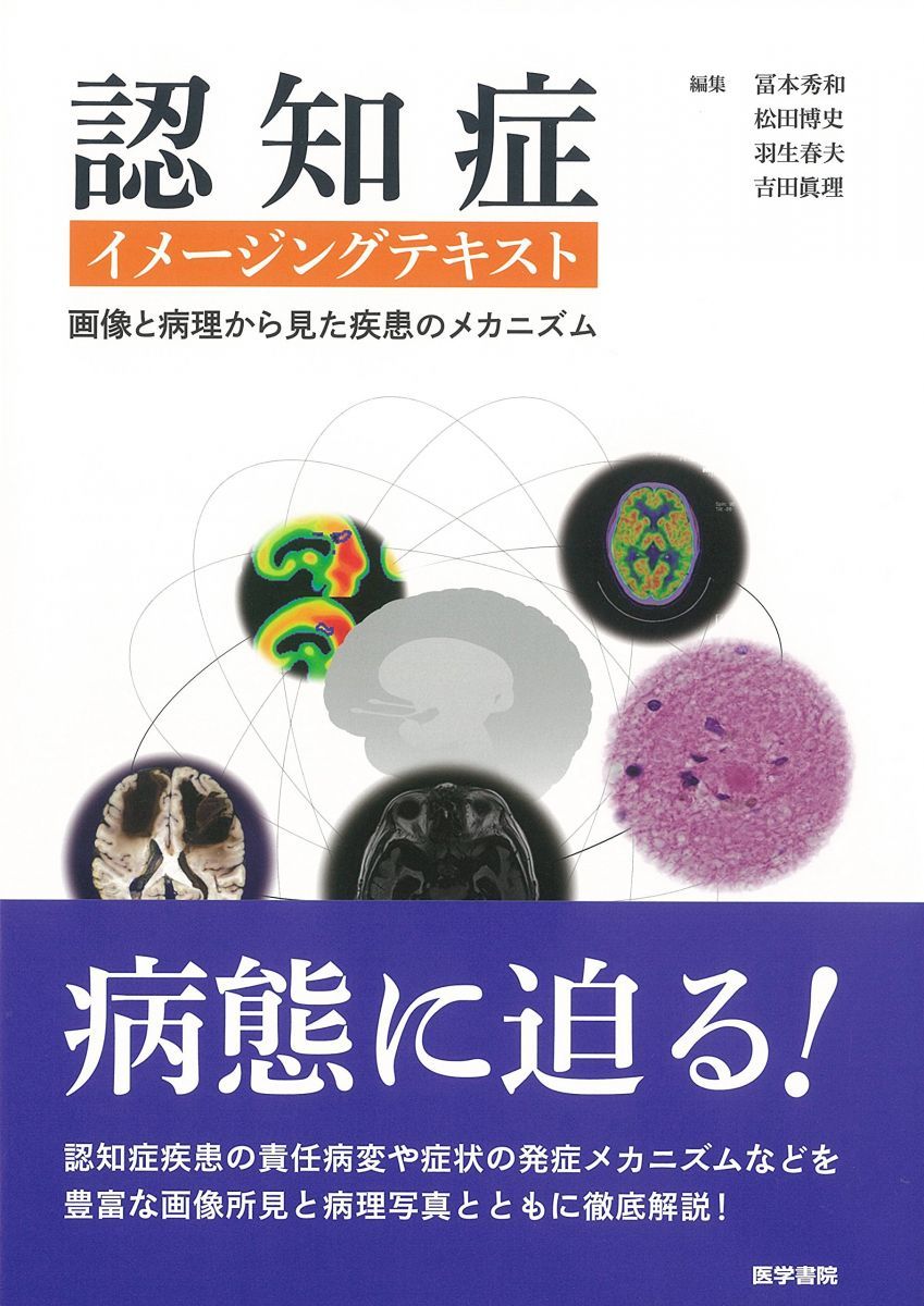 認知症イメージングテキスト: 画像と病理から見た疾患のメカニズム