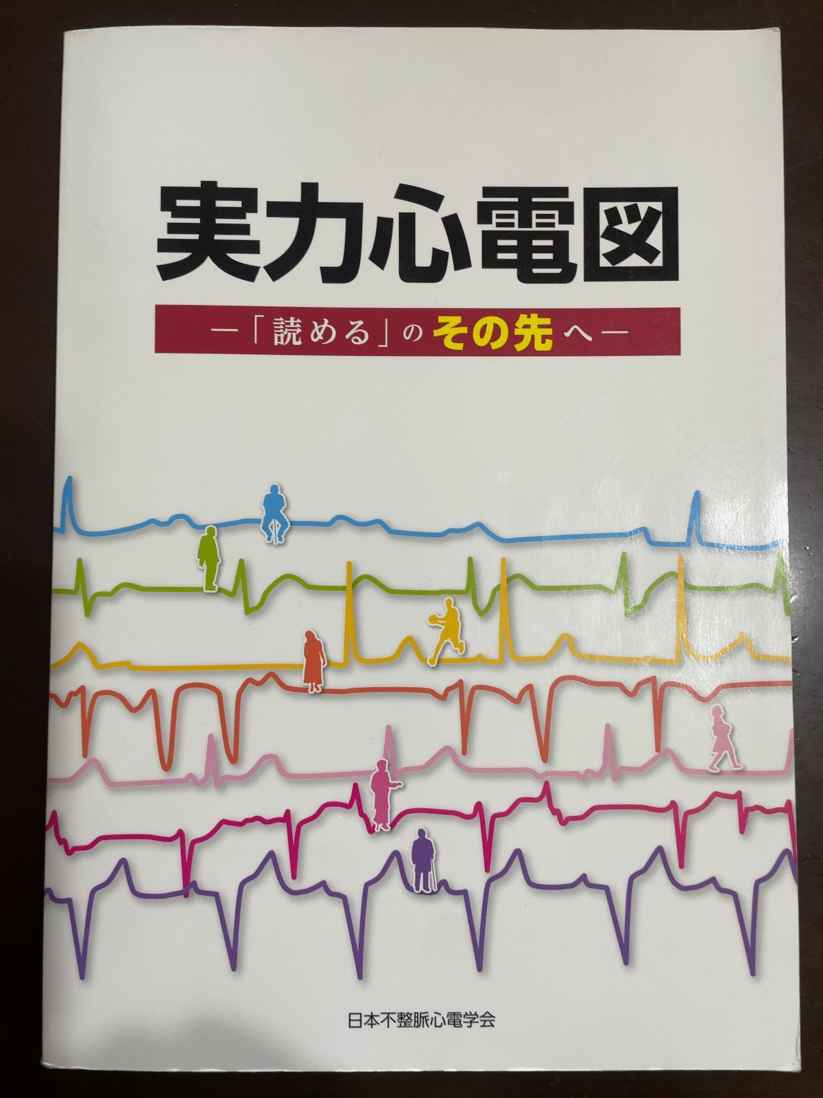実力心電図: 「読める」のその先へ | 日本不整脈心電学会