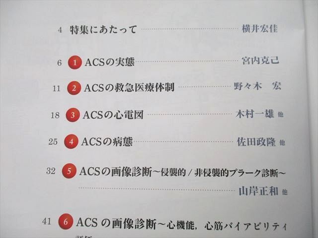 UD25-106 医学出版 月刊 循環器 CIRCULATION ACSの診断と治療 2013年5月号 07m3D