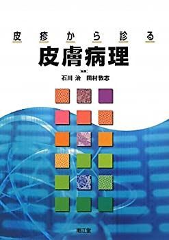 【限定SALE，新作登場】 【中古】 皮疹から診る皮膚病理 その他
