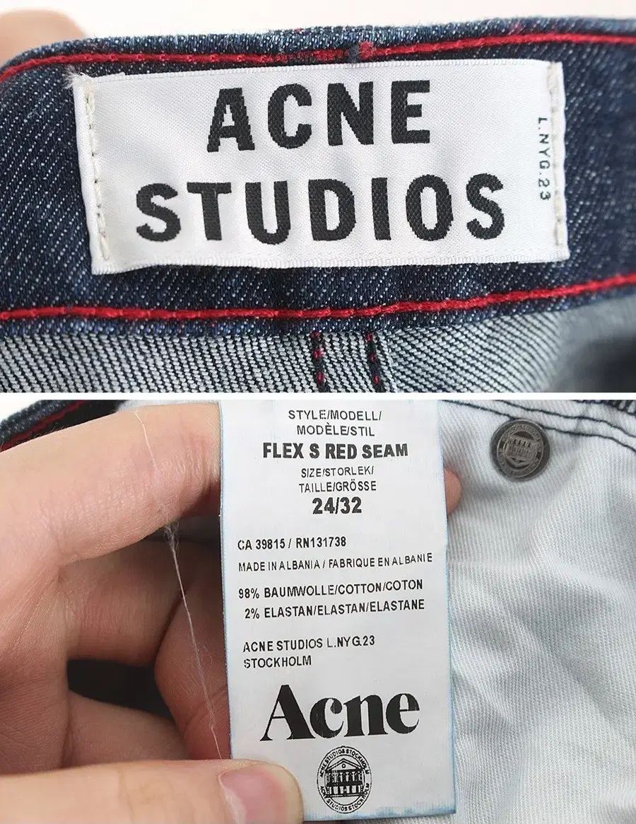 Acne