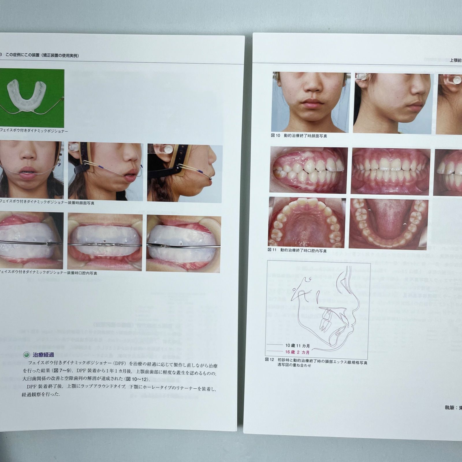 ペリオの臨床戦略を学ぶ歯周動的治療