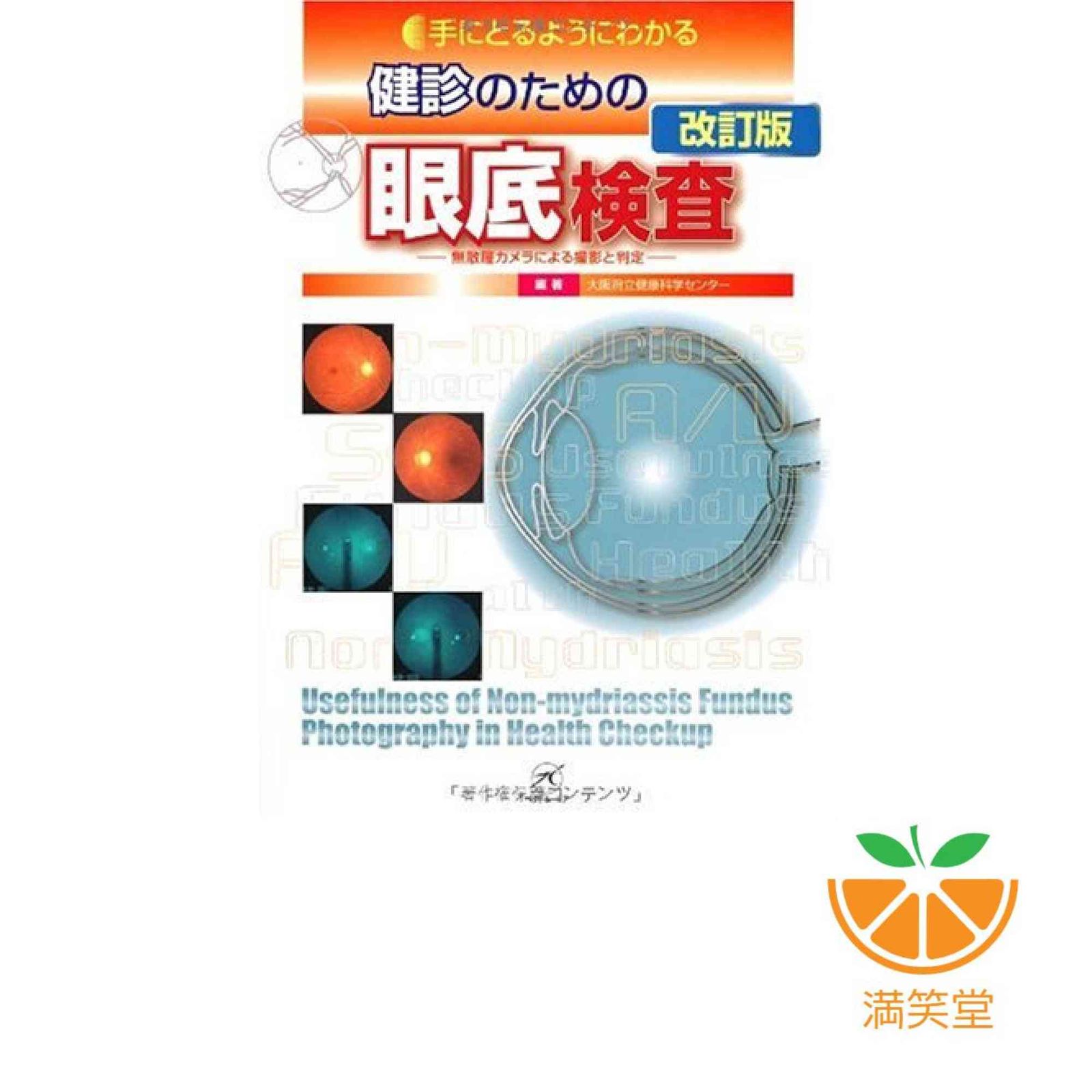 新品　手にとるようにわかる健診のための眼底検査 : 無散瞳カメラによる撮影と判定 健診のための眼底検査 改訂版〜無散瞳カメラによる撮影と判定