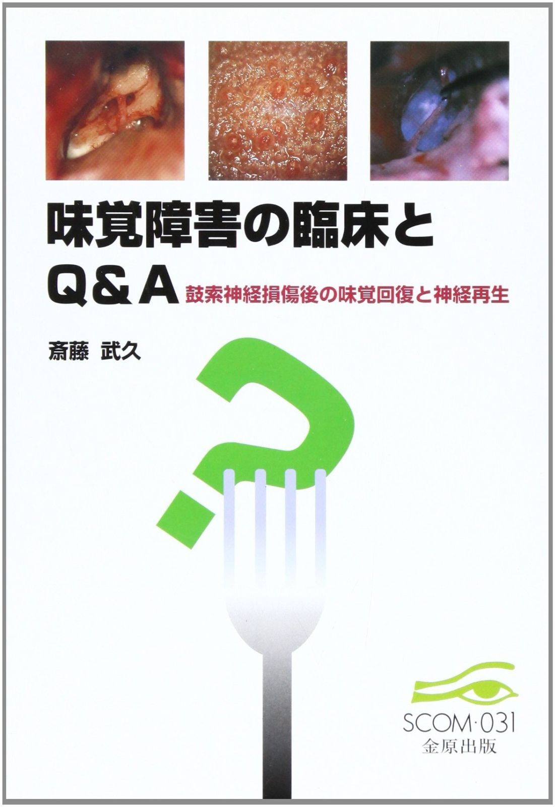 味覚障害の臨床とQ-A 鼓索神経損傷後の味覚回復と神経再生 SCOM