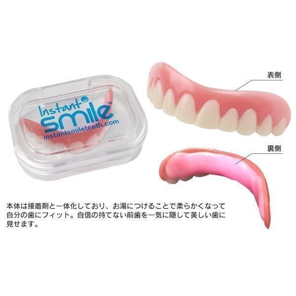 すきっ歯
