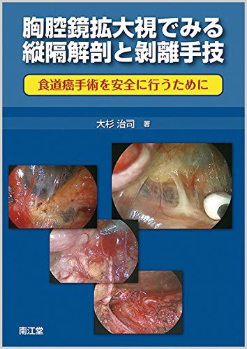 | 胸腔鏡拡大視でみる縦隔解剖と剥離手技: 食道癌手術を安全に行う Achievements 健康と医学 ｜消化器・一般外科｜診療科・部門紹介｜香川県立 胸腔鏡拡大視でみる縦隔解剖と剥離手技: 食道癌手術を安全に行うために 大杉 治司