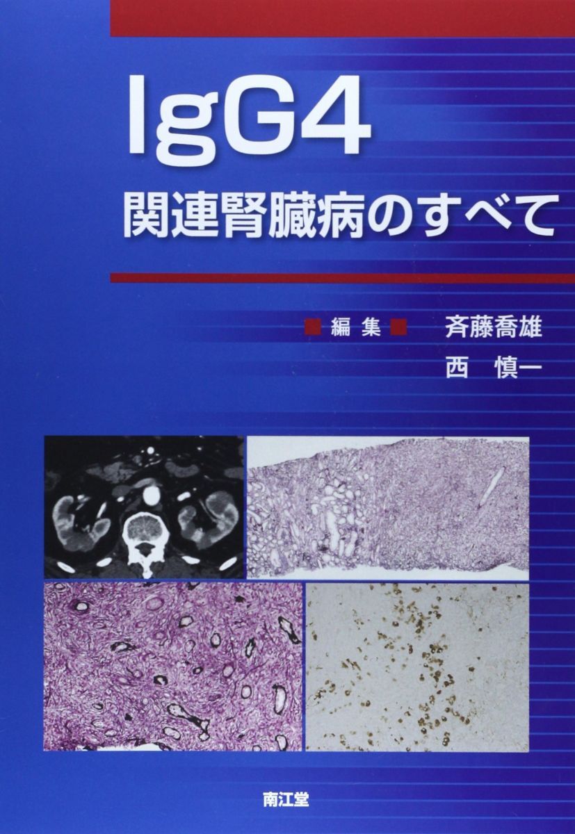 IgG4関連腎臓病のすべて 斉藤 喬雄