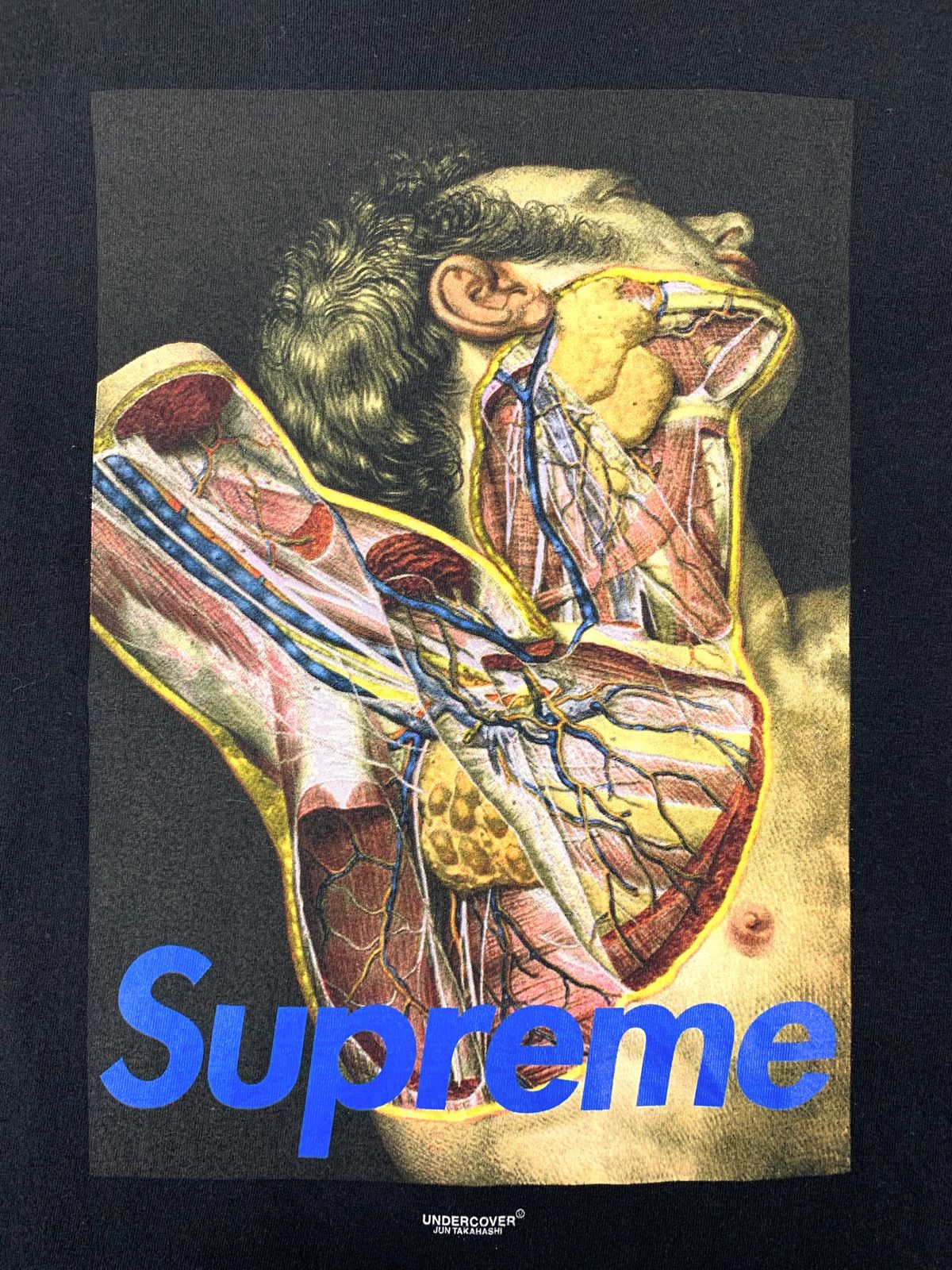 Supreme Undercover 16aw Anatomy Tee