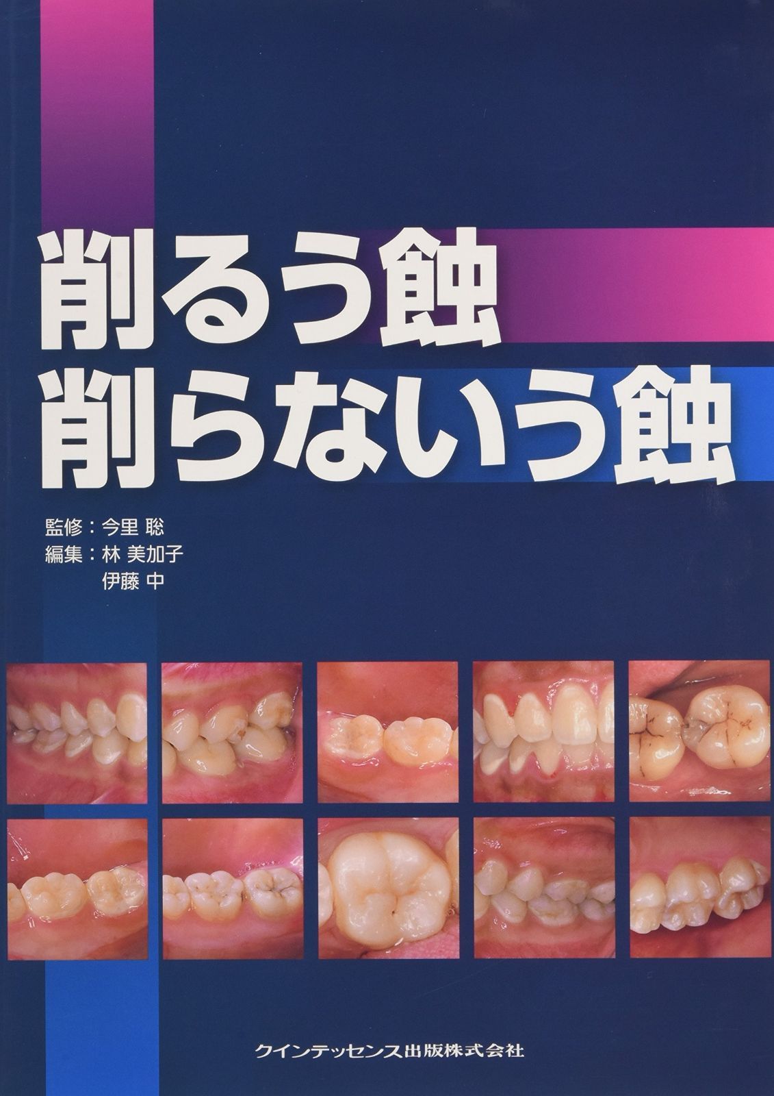 【新作入荷，お買い得】 削るう蝕 削らないう蝕 その他