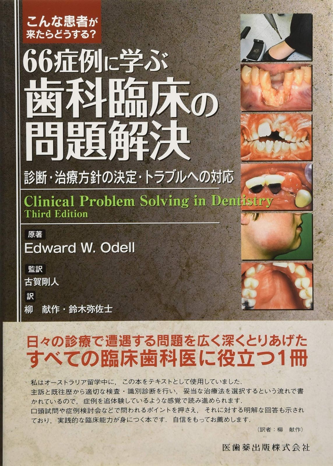  こんな患者が来たらどうする? 66症例に学ぶ歯科臨床の問題解決 診断・治療方針の決定・トラブルへの対応 その他