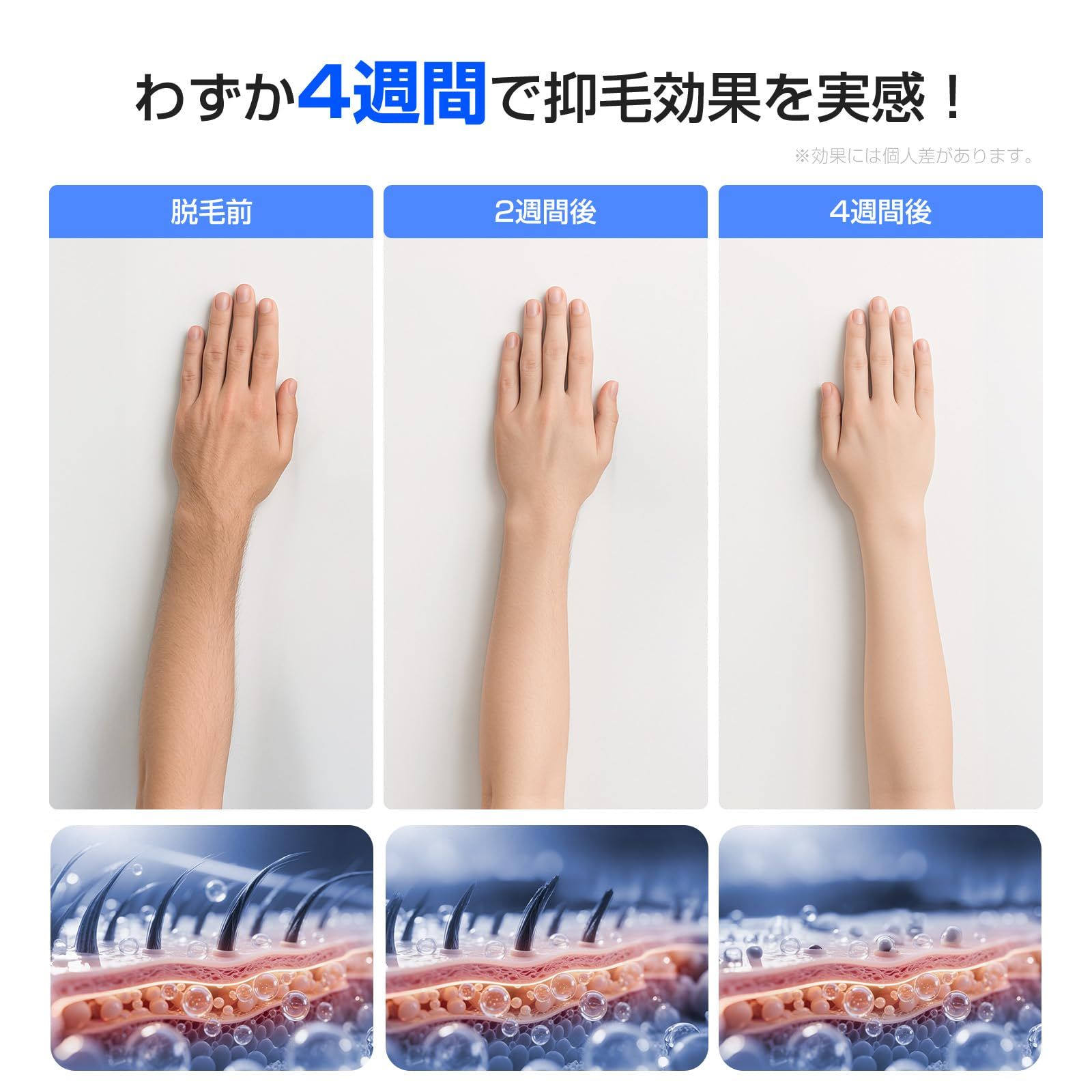 ENUOTEK 脱毛器 VIO対応 メンズサロン級IPL光技術 サファイア冷却最大出力19J 最速0.5秒照射 髭 家庭用 顔 全身 Vライン 男女兼用 100万発耐久 5段階調節 手動 自動照射 静音 美肌 光美容器 保護眼鏡＆カミソリ付き 安定性能 節… WWW_KANDAIZUMI_COM