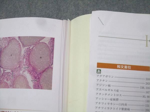 新口腔病理学 新口腔病理学 第3版/医歯薬出版株式会社