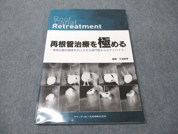 クインテッセンス出版 再根管治療を極める 2011 牛窪敏博 015S3D 再根管治療を極める | 牛窪 敏博, 石井 宏, 尾上 正治, 尾上